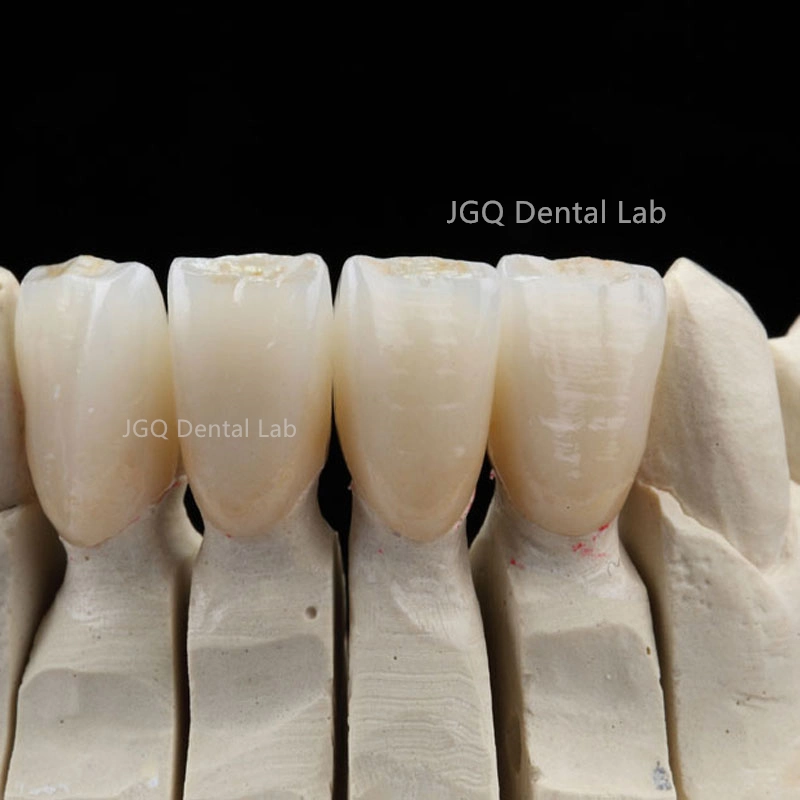 Zirconio contorno completo todos Ceramic Corona y Puentes Dental Lab En China