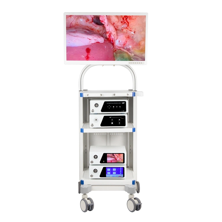 Medical Hospital Camera System Laparoscopic Complete Set