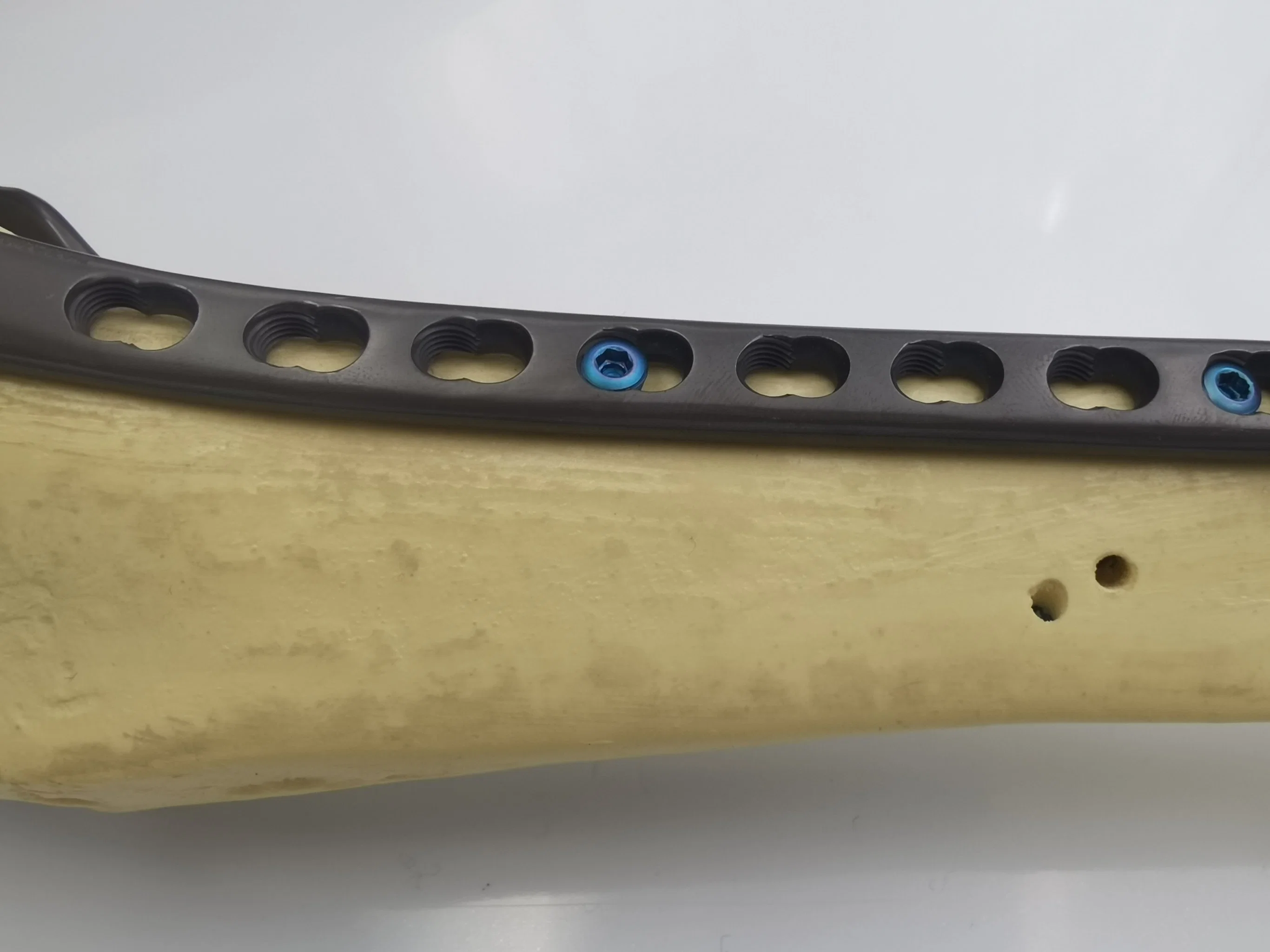 Titanium Trauma Lower Limb Orthopedic Implants Proximal Tibial Medial Locking Plate