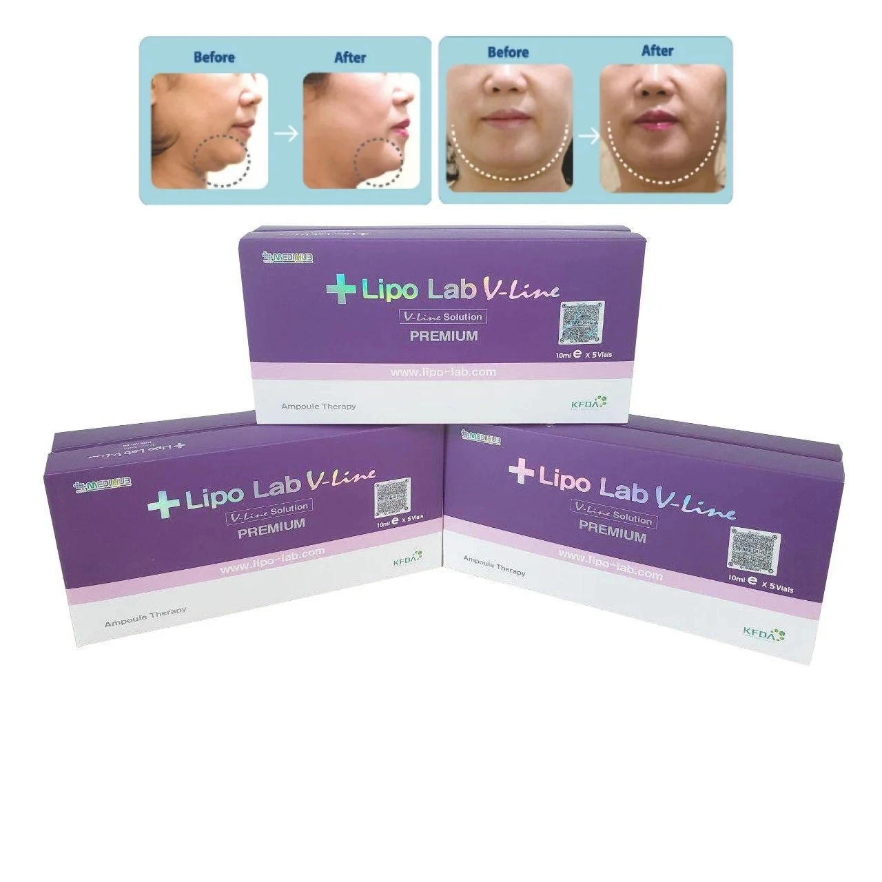 2023 Korea Hot Selling Lipo Lab Lipolab V-Line Kabelline Injectable Body Weight Loss Lipo Lab Lipolysis for Slimming Thin Face to Form a V Line