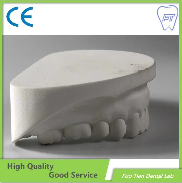 Removíveis personalizadas Denture expressos Quadro Parcial Dental