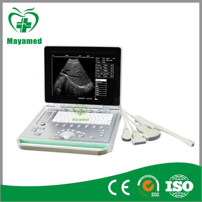 My-A009 15inch Screen PC Based Laptop Ultrasound B Scanner