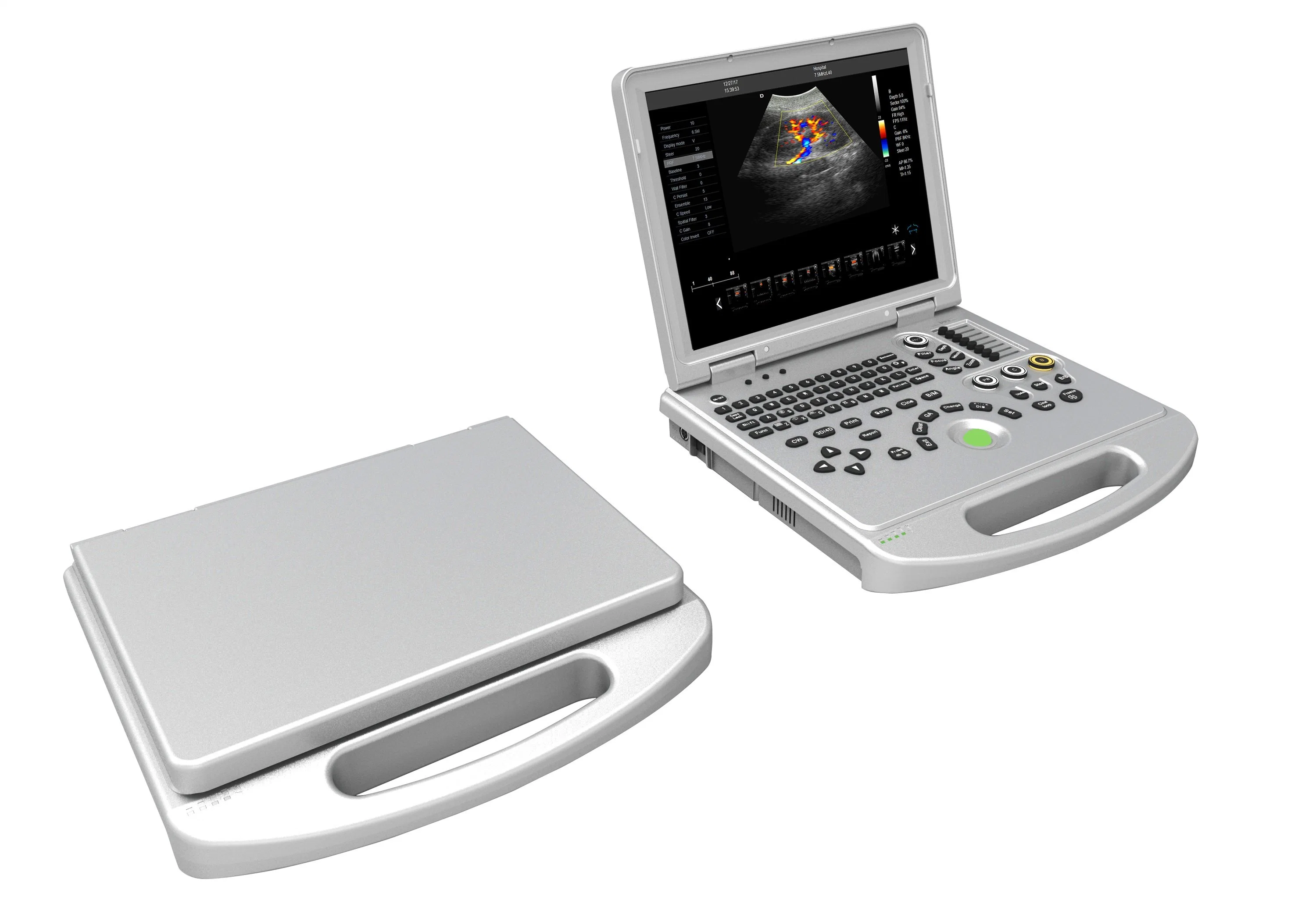 Digital Notebook Ultrasound Scanner (AM-2018)