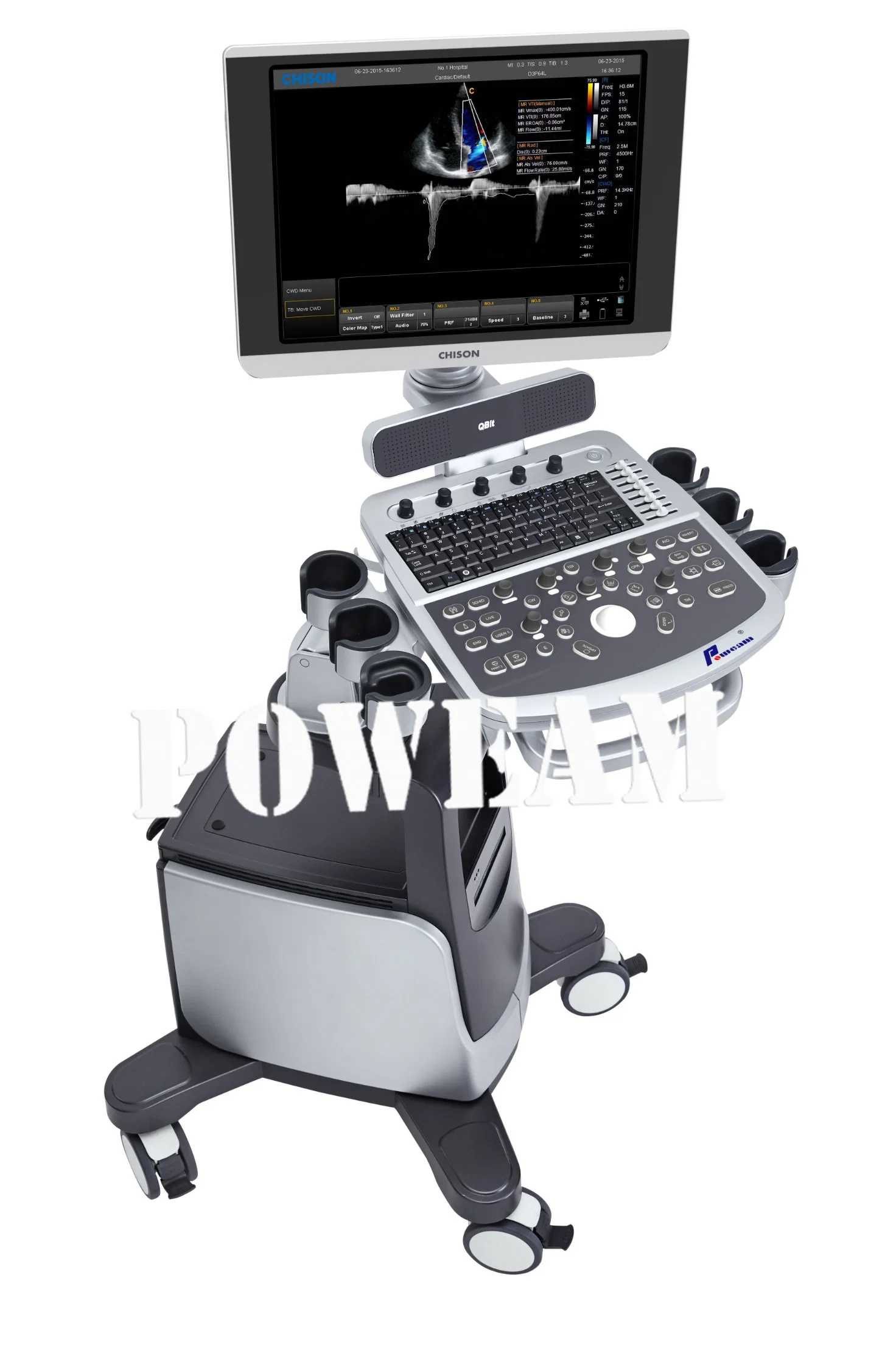 Chison Qbit 7 Color Doppler Ultrasound Machine