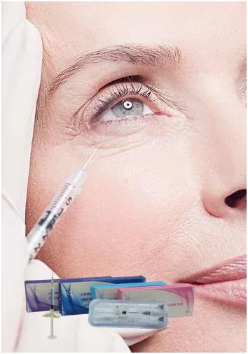 Injection Hyaluronic Acid Dermal Filler Anti-Aging Wrinkles