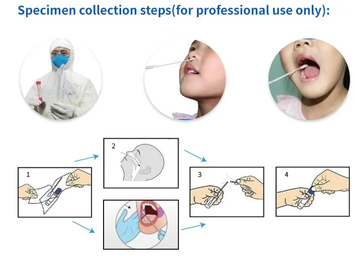 Virus Sampling Tube Disposable Virus Specimen Collection Tube Vtm Kits