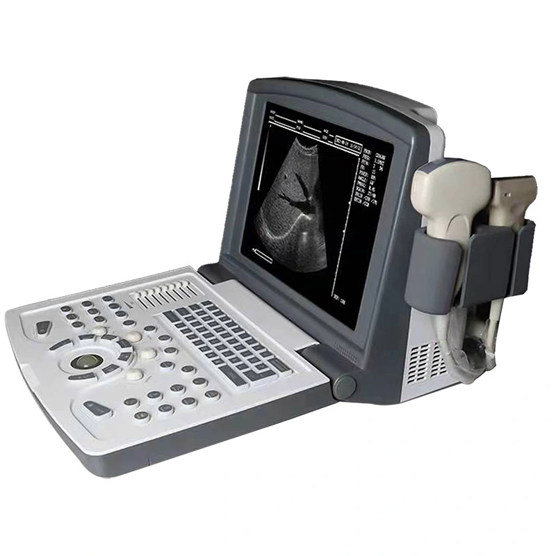 B/W Ultrasound Machine for Liver/ Gallbladder/Pancreas/Spleen Examination