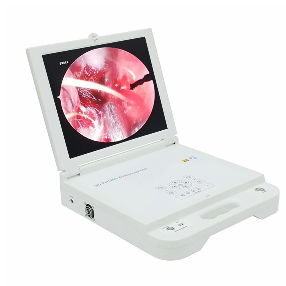 Portable Video Endoscopy Camera Medical Ent Endoscope