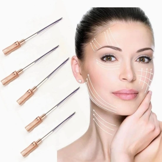 Distributor Wanted 18g 100mm W Blunt Cannula Needle 6D Cog Fios De Pdo Thread Lift for Face Lifting Korea