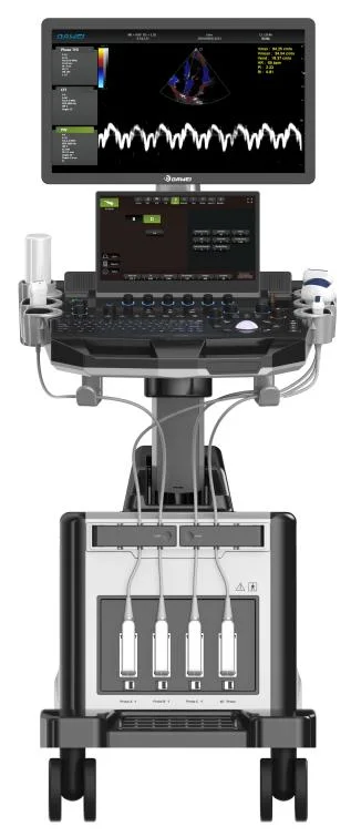 Échographie clinique Doppler couleur 4D avec fonction Elastographie