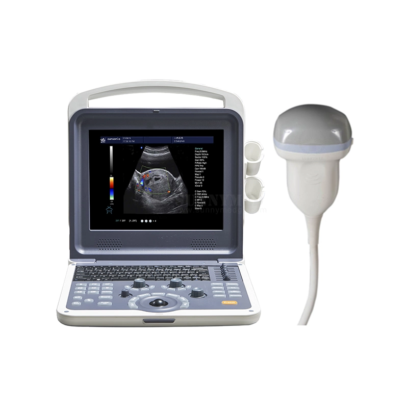 Sy-A042n Cheap Color Doppler Handy Baby Scanner Medical Digital Ultrasonography Ultrasound Machine Price