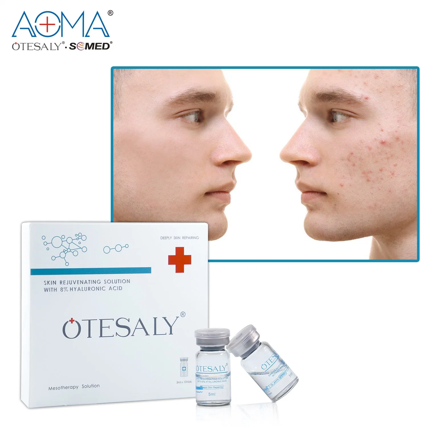 50ml Injectable Hyaluronic Acid Skin Rejuvenation Whitening Injection Mesoterapia Serum Otesaly Price