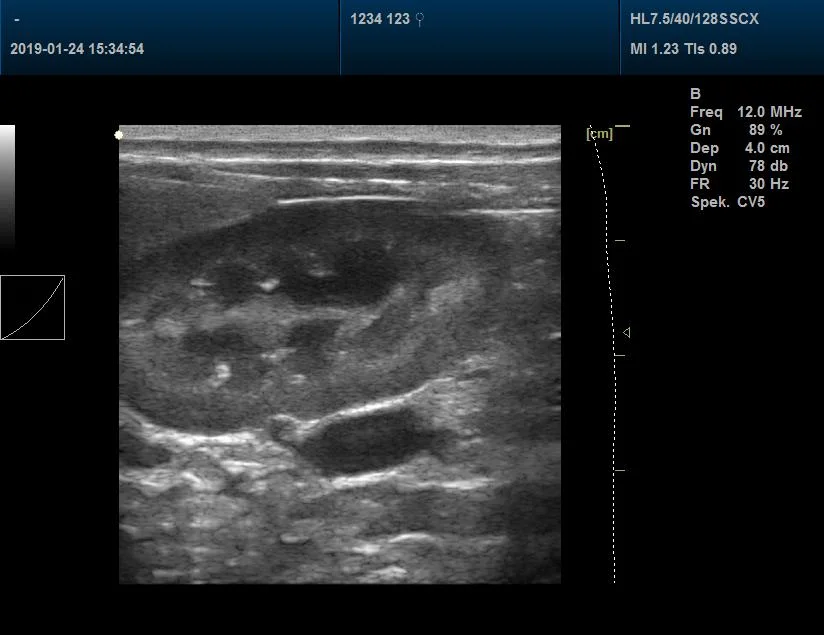 شاشة LCD عالية الجودة، وضع B الرقمي بالكامل، ماسحة بالموجات فوق الصوتية، محمولة جهاز الموجات فوق الصوتية للاستخدام في Vet