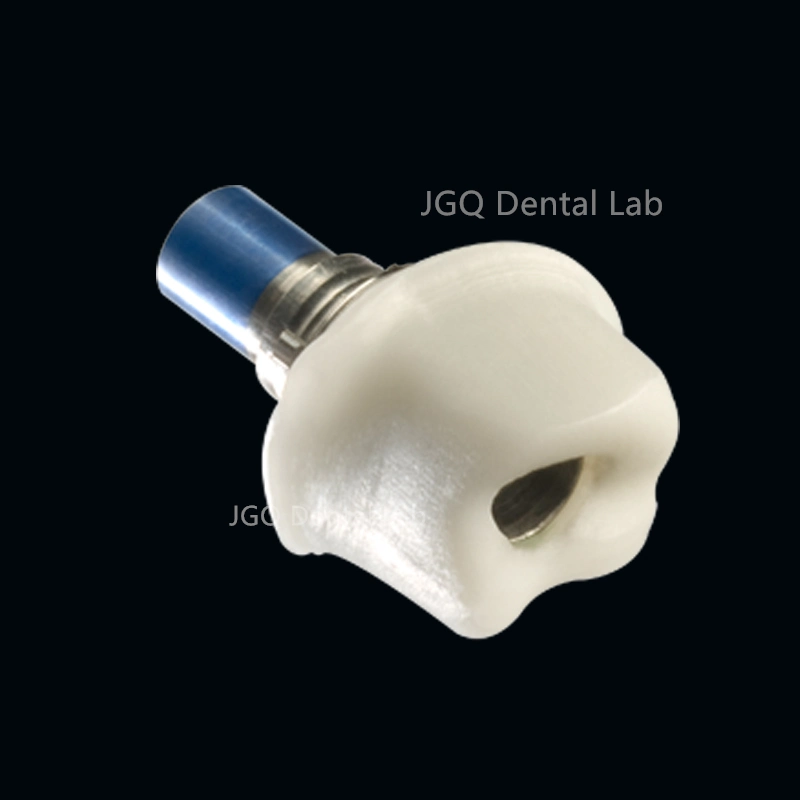 Dental Lab Custom Implant Abutments Titanium and Zirconia Used for Implant Cases