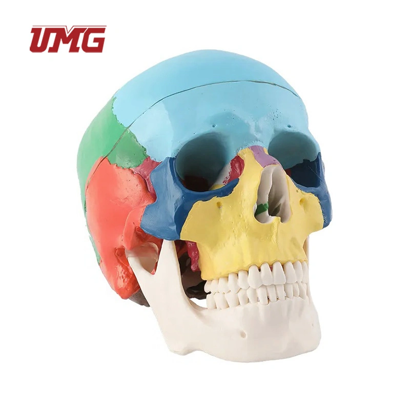 Colorful Skull Model Anatomical with Titanium Plate for Medical Training