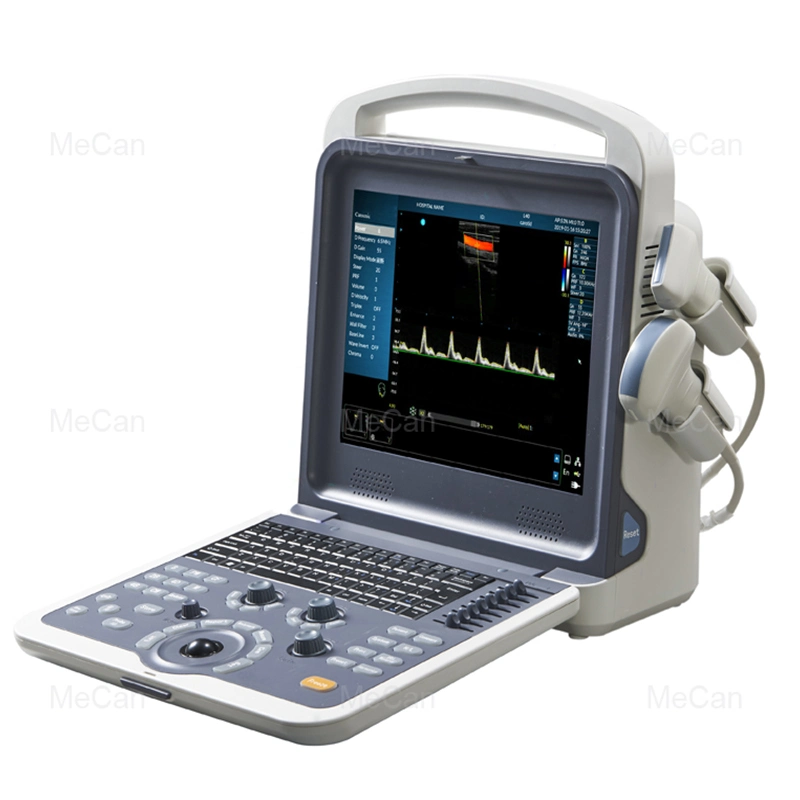 Scanner de ultrassons portátil com sistema de diagnóstico de ultrassons Doppler a cores totalmente digital