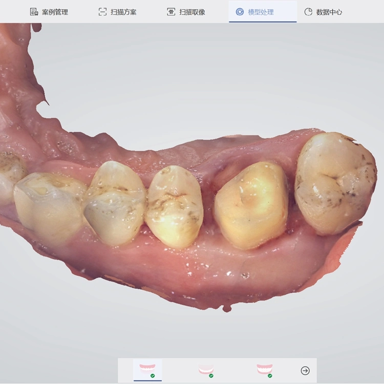 Китай Panda 2 Синяя Интраоральный сканер 3D Dental Lab CAD Цена CAM с CE