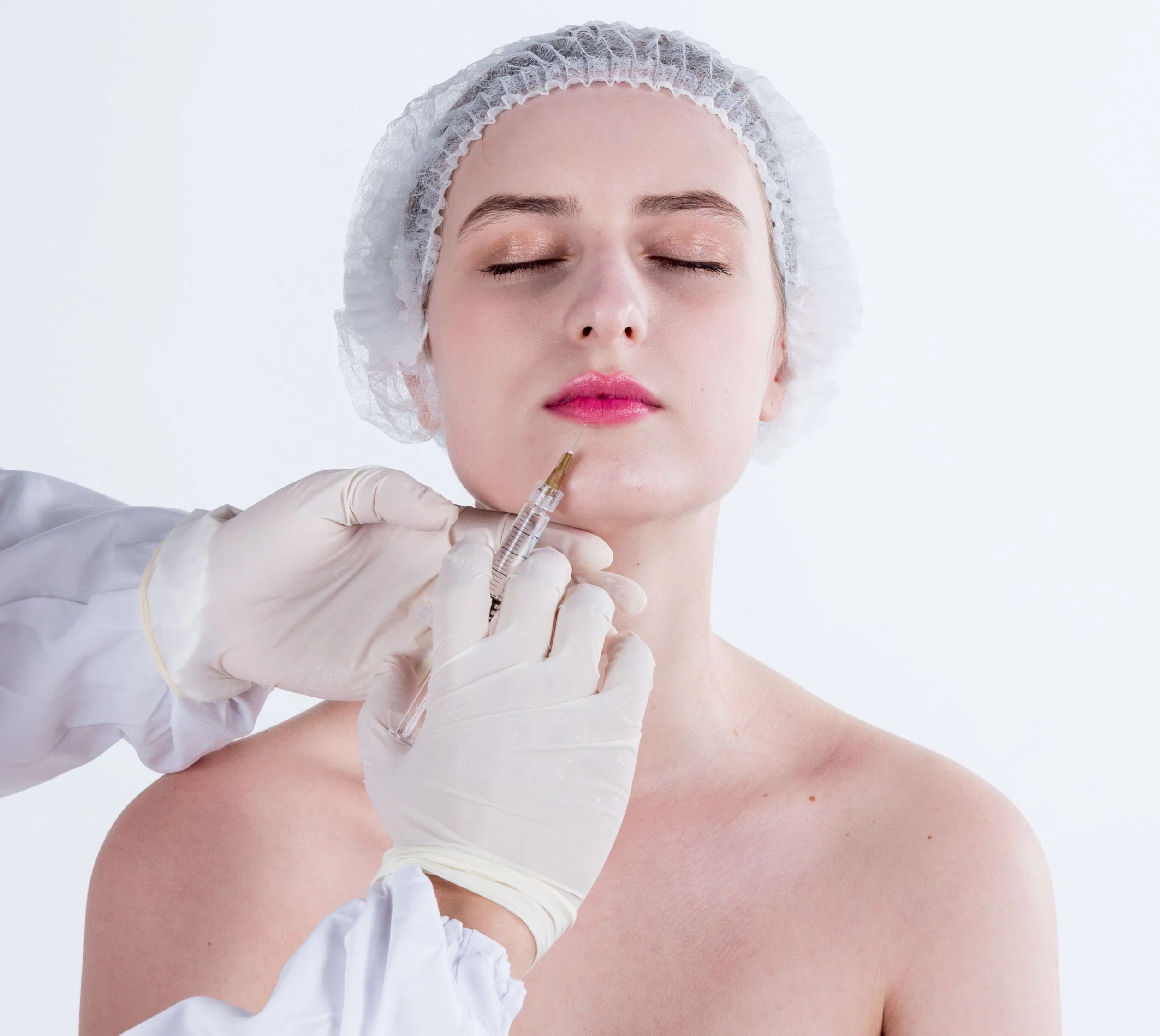 Sterile, biologisch abbaubare Hyaluronsäure Injection Dermal Filler mit CE-Zulassung