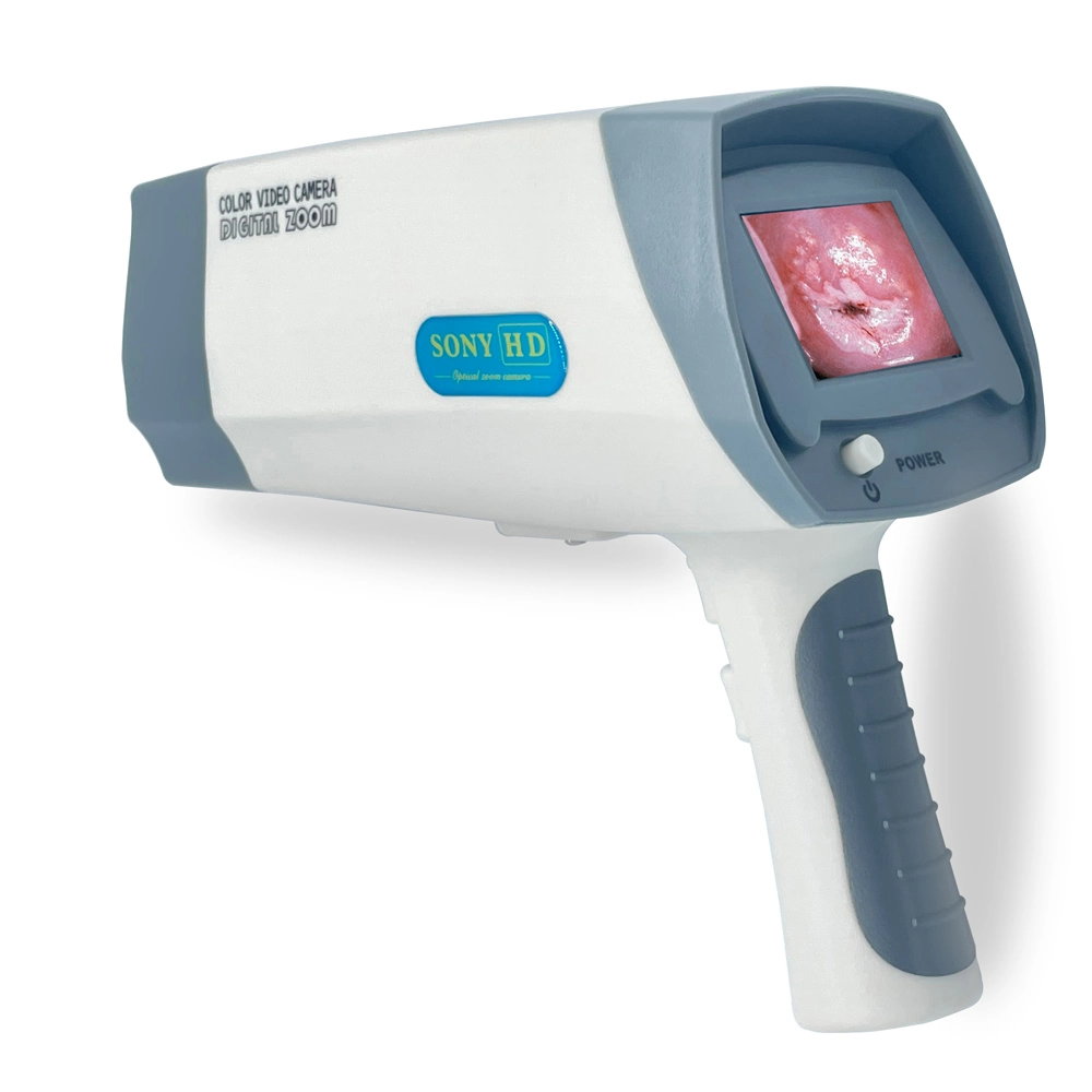 Electronic Full Digital Multi-Language Colposcope