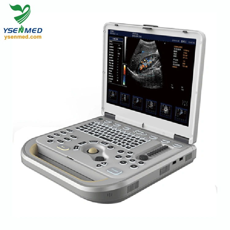 Medical Ysb-M80 Laptop Color Doppler Ultrasound System