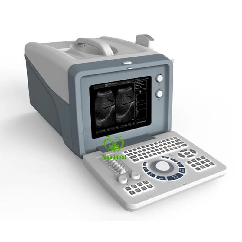 My-A001A Medical Diagnosis Equipment Cheap Ultrasound Scan Machine Portable