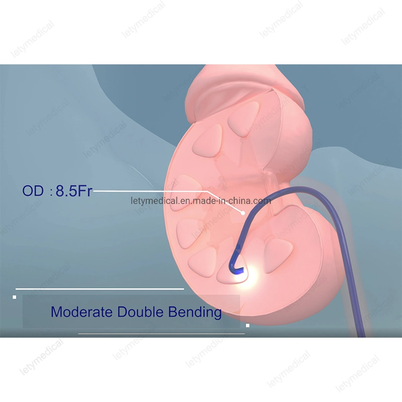 High quality/High cost performance  Urology Single-Use Flexible Video Ureteroscope Digital Disposable Urethroscope Endoscope Uretero-Renoscope