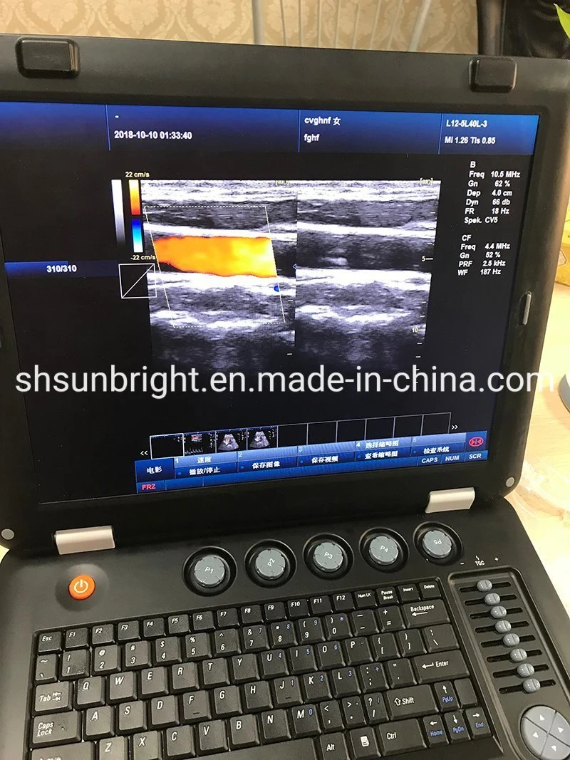 CF+B Pw Cw Function Color Doppler Ultrasound Scanner with Ce