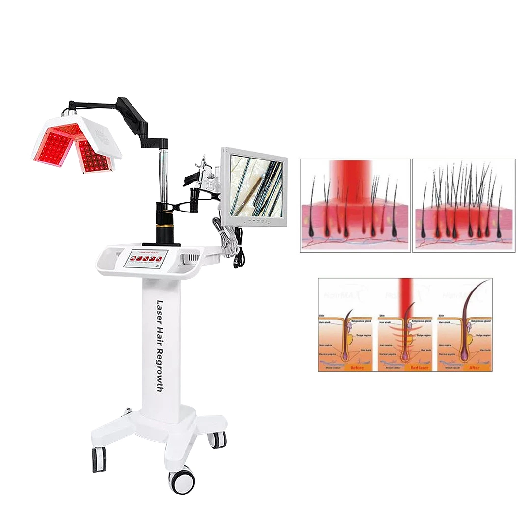 المعالجة المهنية المضادة لفقدان الشعر الصمام الثنائي الليزر آلة إعادة نمو الشعر