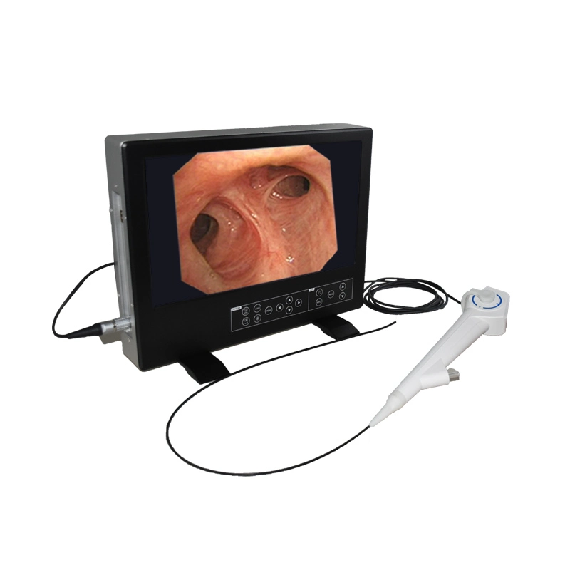 Processeur d'image d'endoscope médical électronique