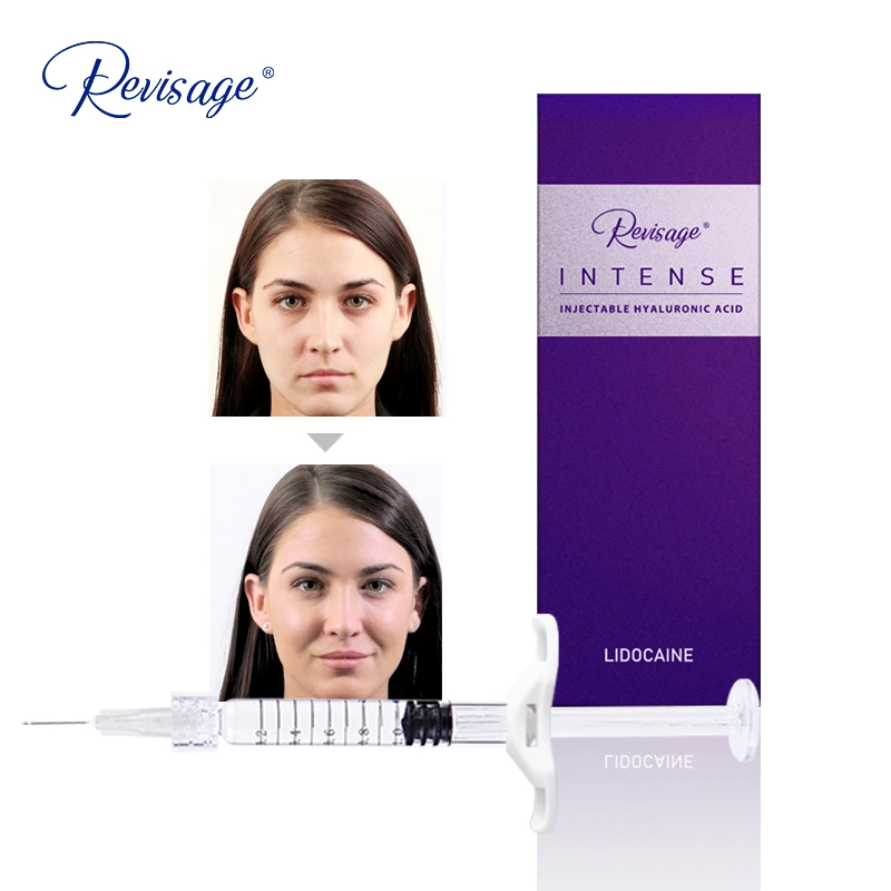 Revisage Best Deep Wrinkle Filler Injections Filler 1 Ml Lip Hyaluronic Acid Filler 1ml Syringe