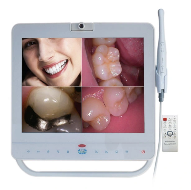 All in One Wired/ Wireless Intra Oral Camera