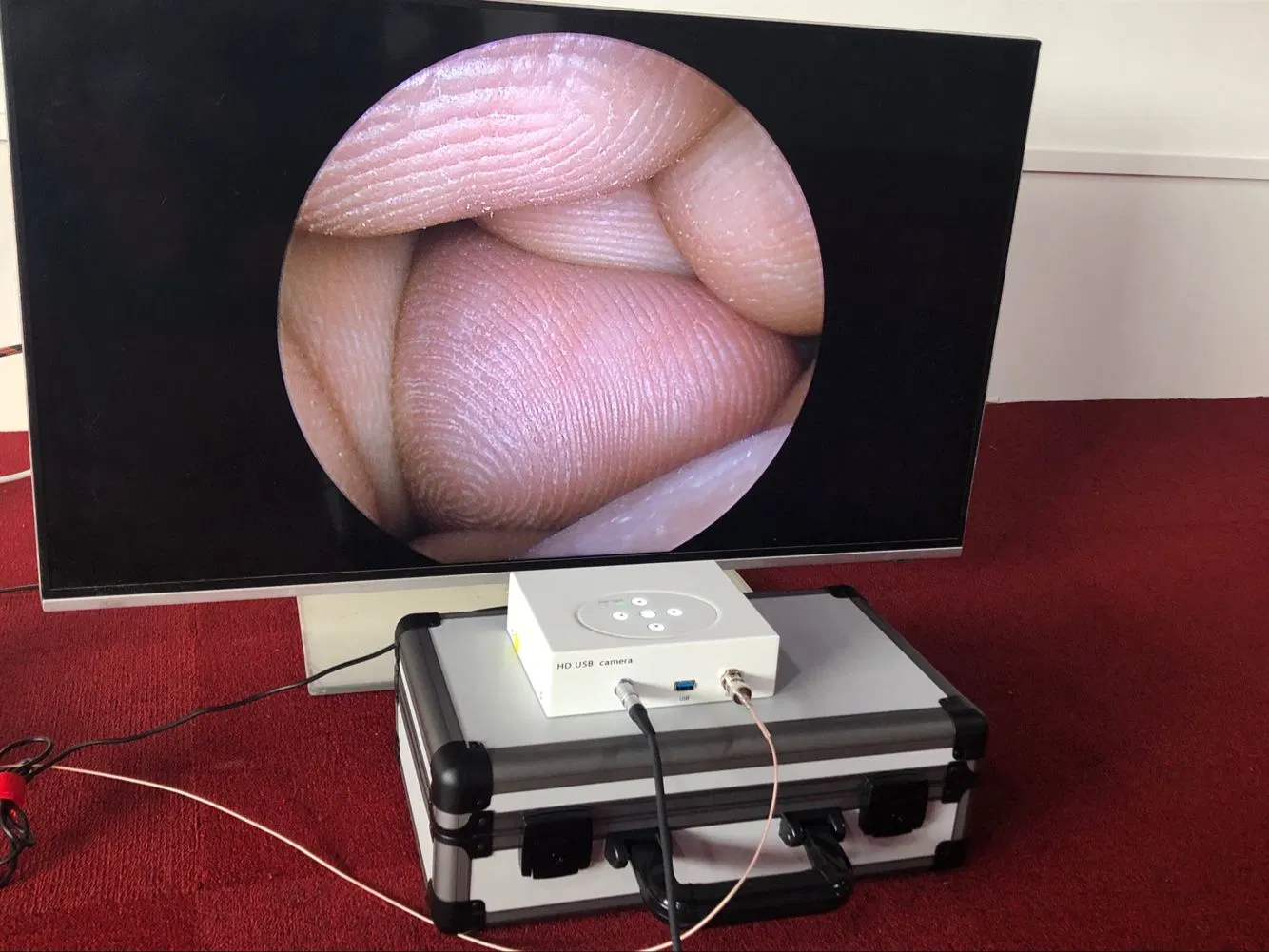 1080 P portátil médico endoscopio cámara admite Storz Wolf Stryker Acmi USB Endoscopio