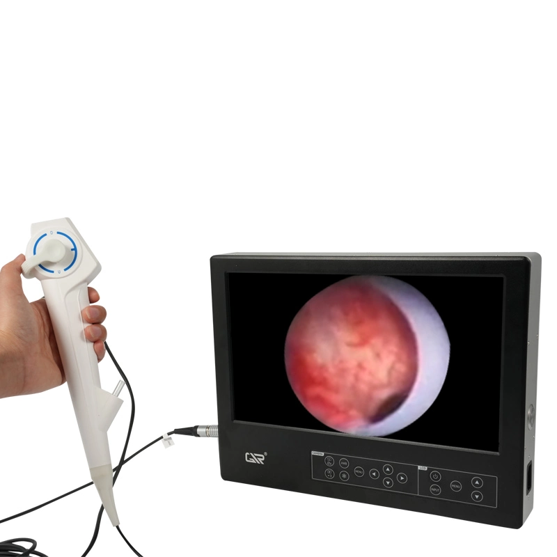 Medical HD Flexible Integrated Ureteroscope with 13.3&rdquor;