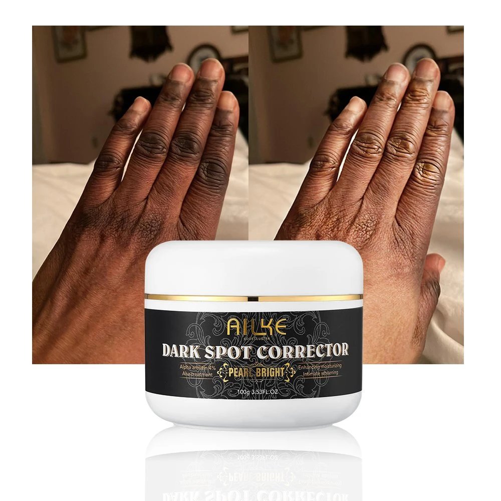 Organic Ingredient Dark Spot Corrector Face Fade out The Skin Black Remove Freckle for Face Fade Spots