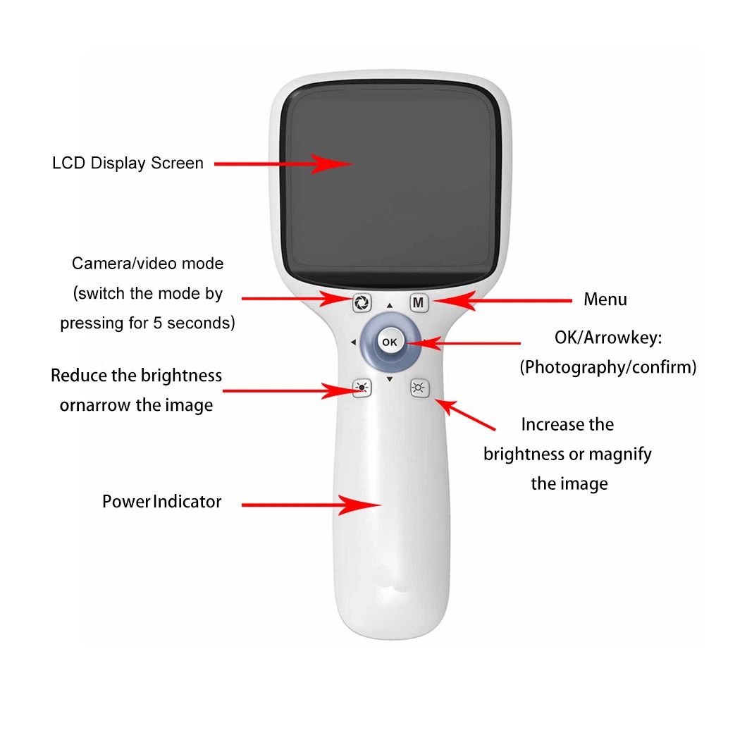 Hes-1000 Portable Handheld Non-Mydriatic Digital Fundus Retinal Camera