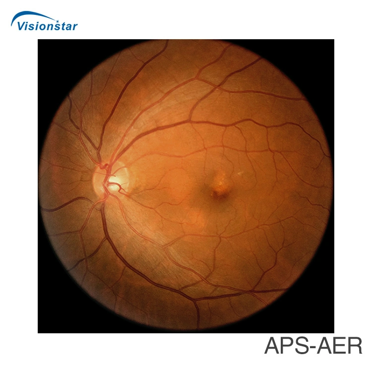 with Ce FDA Approved Fundus Camera