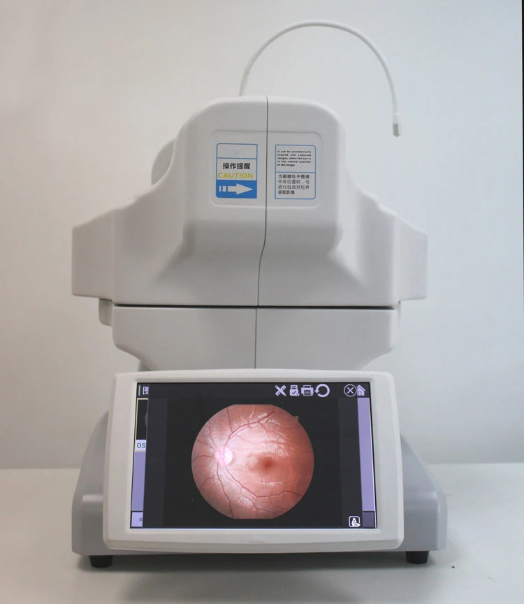 My-V036b Auto Detected The Eye Position Fundus Camera Digital Fundus Photography Retina Camera Price for Ophthalmology