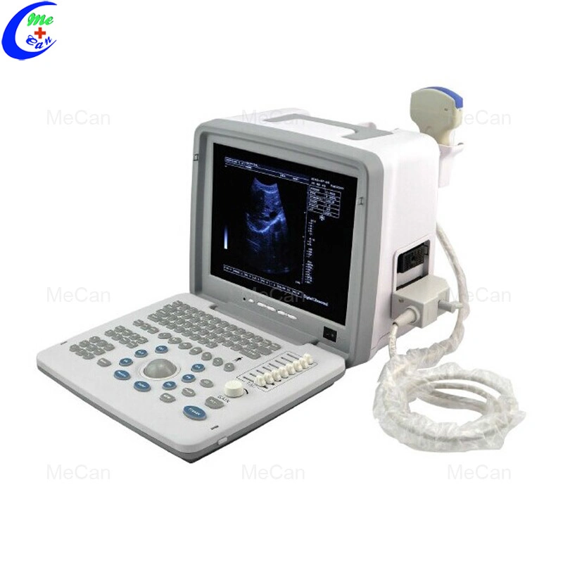 Most Popular Medical LED Portable Ultrasound Scanner