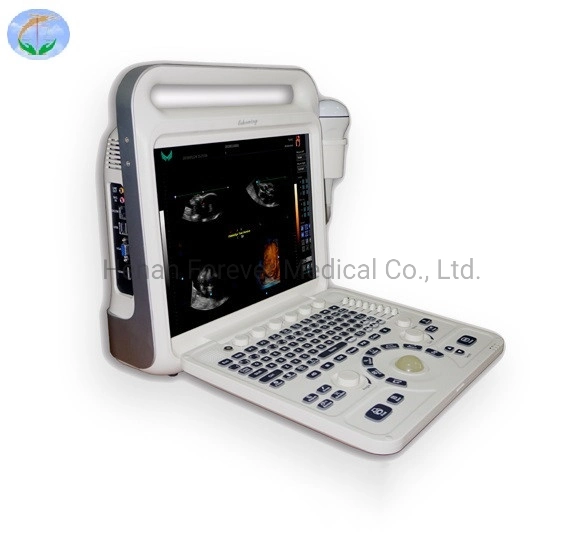 High End Laptop Color Doppler Ultrasound Diagnostic System with Low Price