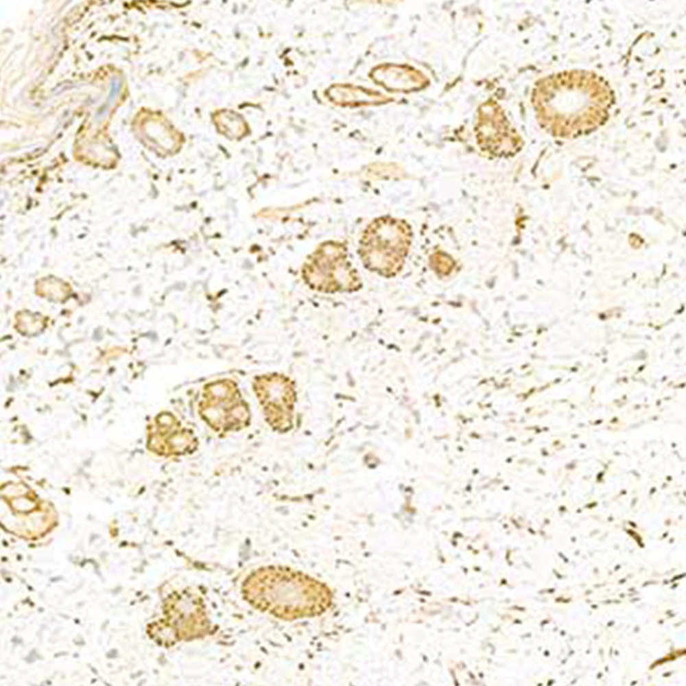 Anti -S100 Alpha 6/Pra Rabbit Primary Polyclonal Antibody