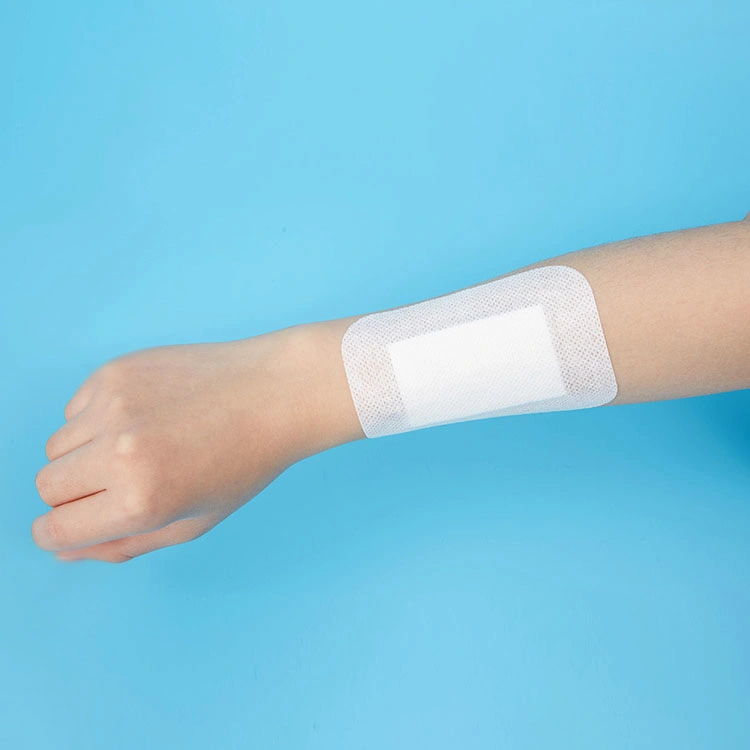 Nonwoven Adhesive Wound Dressing