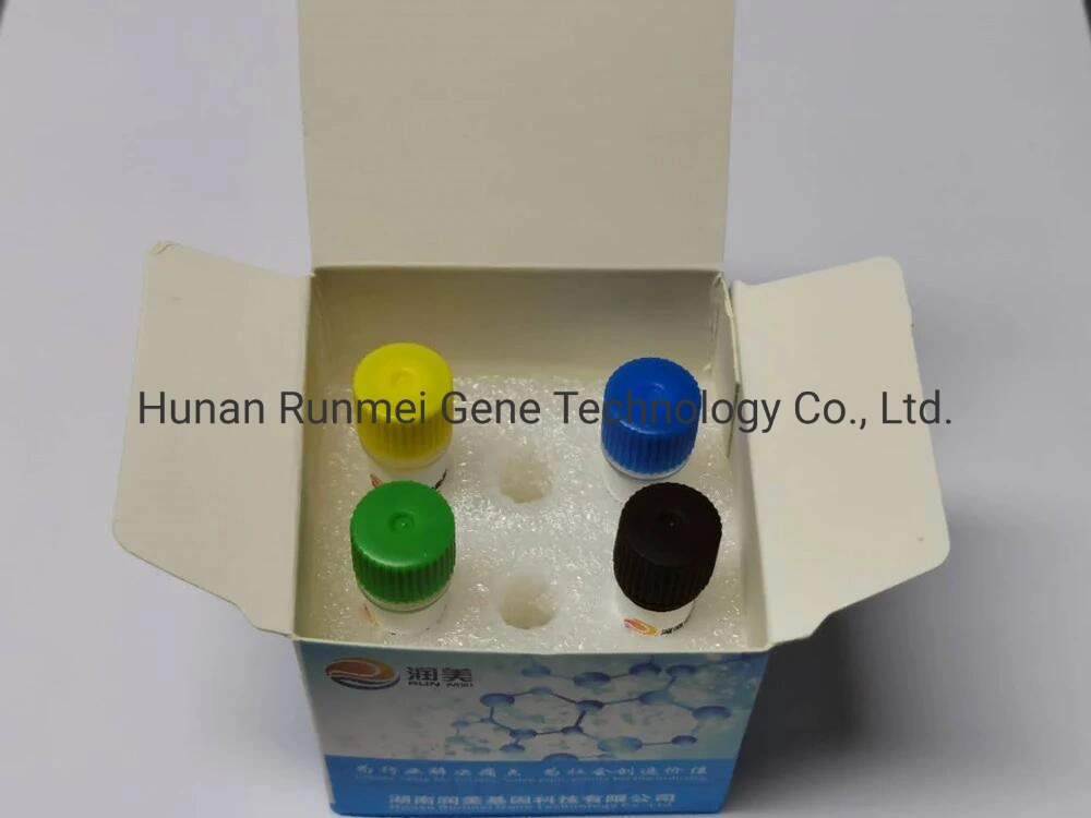 Runmei Factory Supply Monkeypox Rapid PCR Test Kit, Wholesale/Supplier Monkeypox Virus, Monkeypox Molecular Biology Reagents Monkeypox Virus PCR Rapid Diagnostic Kit