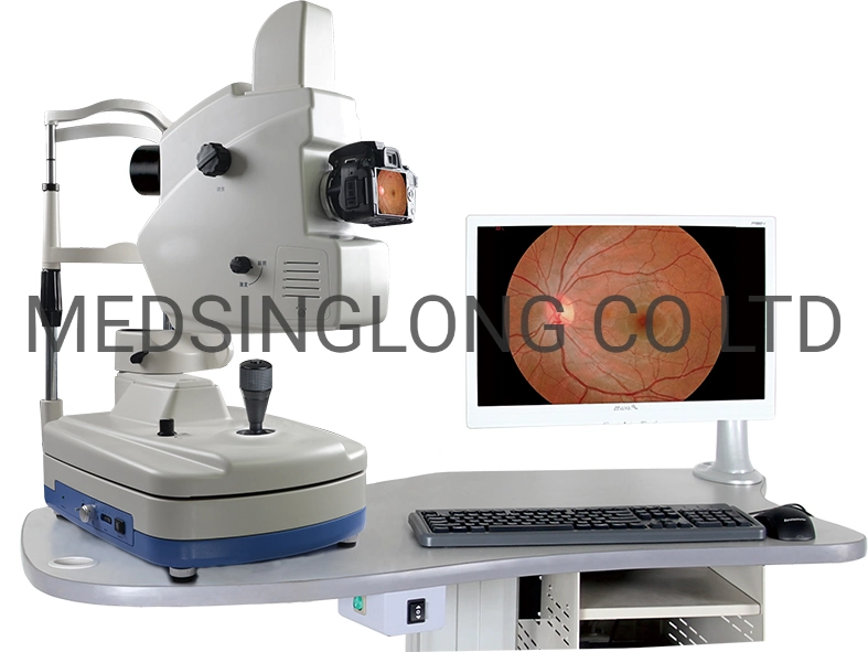 Fundus automática de alta definición cámara óptica oftálmica Mslafc equipo02