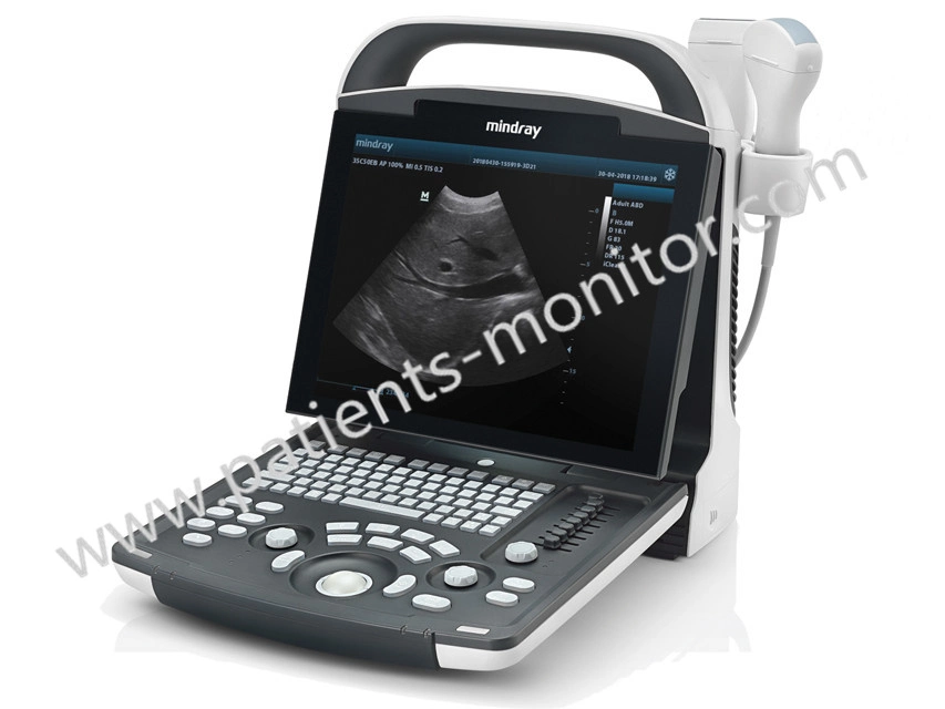 Mindray Dp10 Digital Ultrasonic Diagnostic Imaging System Used Ultrasound Medical Equipment