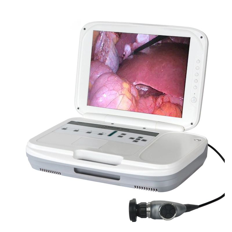 Venta caliente 3 en 1 Equipo Médico endoscopio integrado sistema de cámara de endoscopia endoscopia