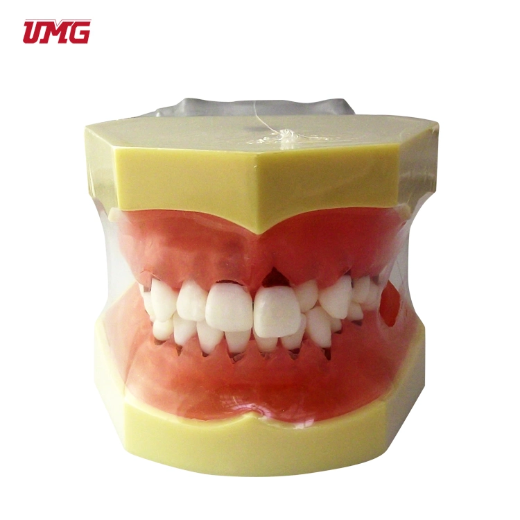 Periodonral Disease Model Teeth and Dental Model