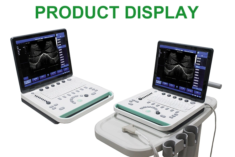 IN-A032-2 Diagnóstico Full Digital Laptop Home Ultrasound Scanner Ultrasonido máquina