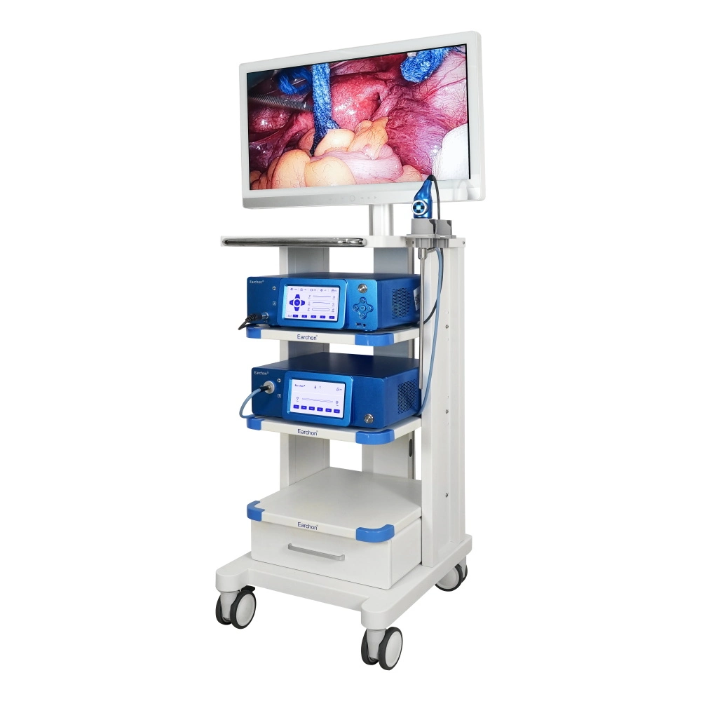 Cost-Effective Medical 4K Endoscope Camera Used for Abdominal Thoracic Surgery at Factory Price