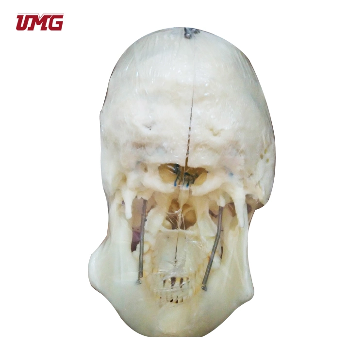 10 Parts Skull Anatomical Demonstration Model with Sinuses