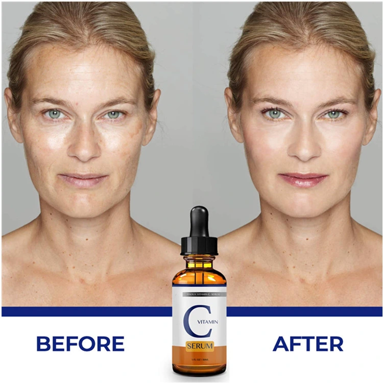 Private Custom Anti-Aging & Anti-Wrinkle Treatment Vitamin C Serum